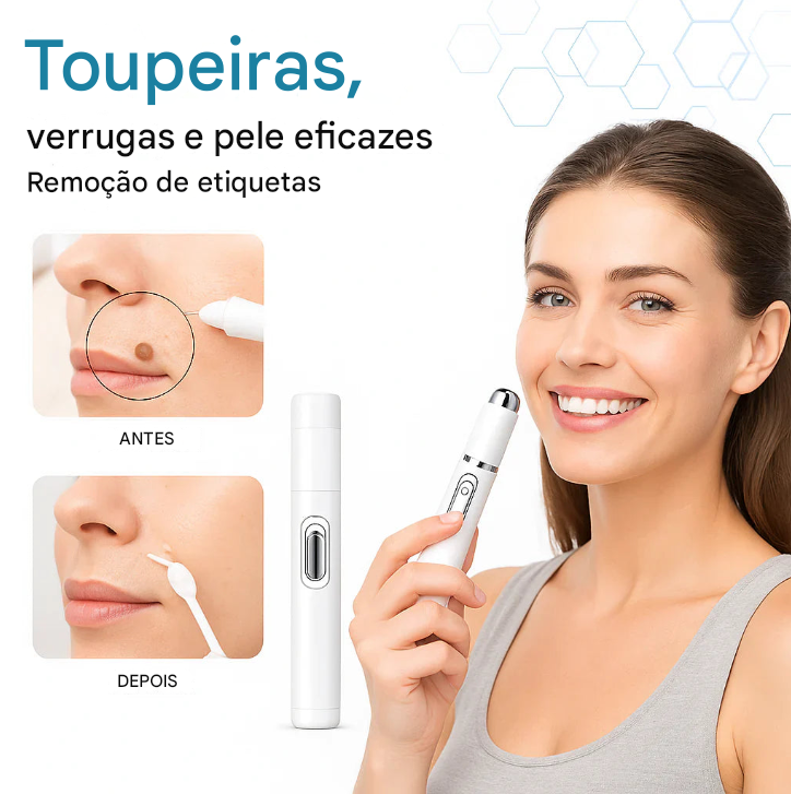 MediSkin Laser – Elimine Manchas e Verrugas | Resultados Rápidos