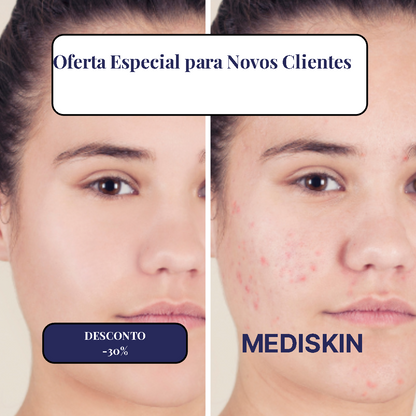 MediSkin Laser – Elimine Manchas e Verrugas | Resultados Rápidos